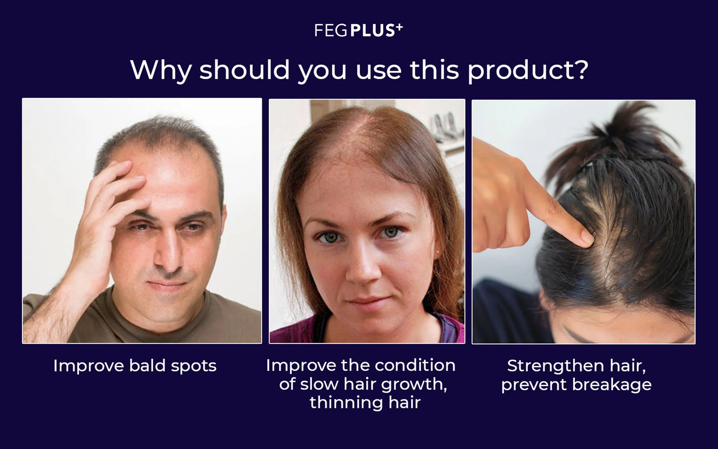 Most Viral FEG Plus Hair Growth Spray